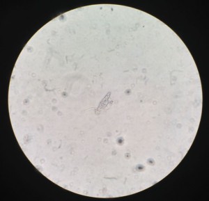 A small clump of mesenchymal stem cells extracted from the fat of grocery store bought chicken.