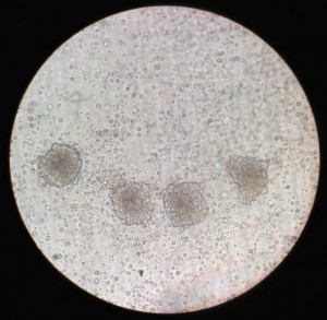Embryoid bodies from iPS(IMR90) stem cells.