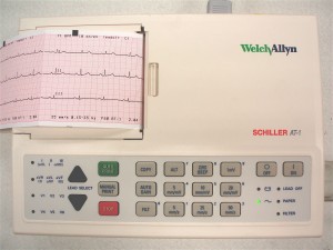 ECG (electrocardiogram)